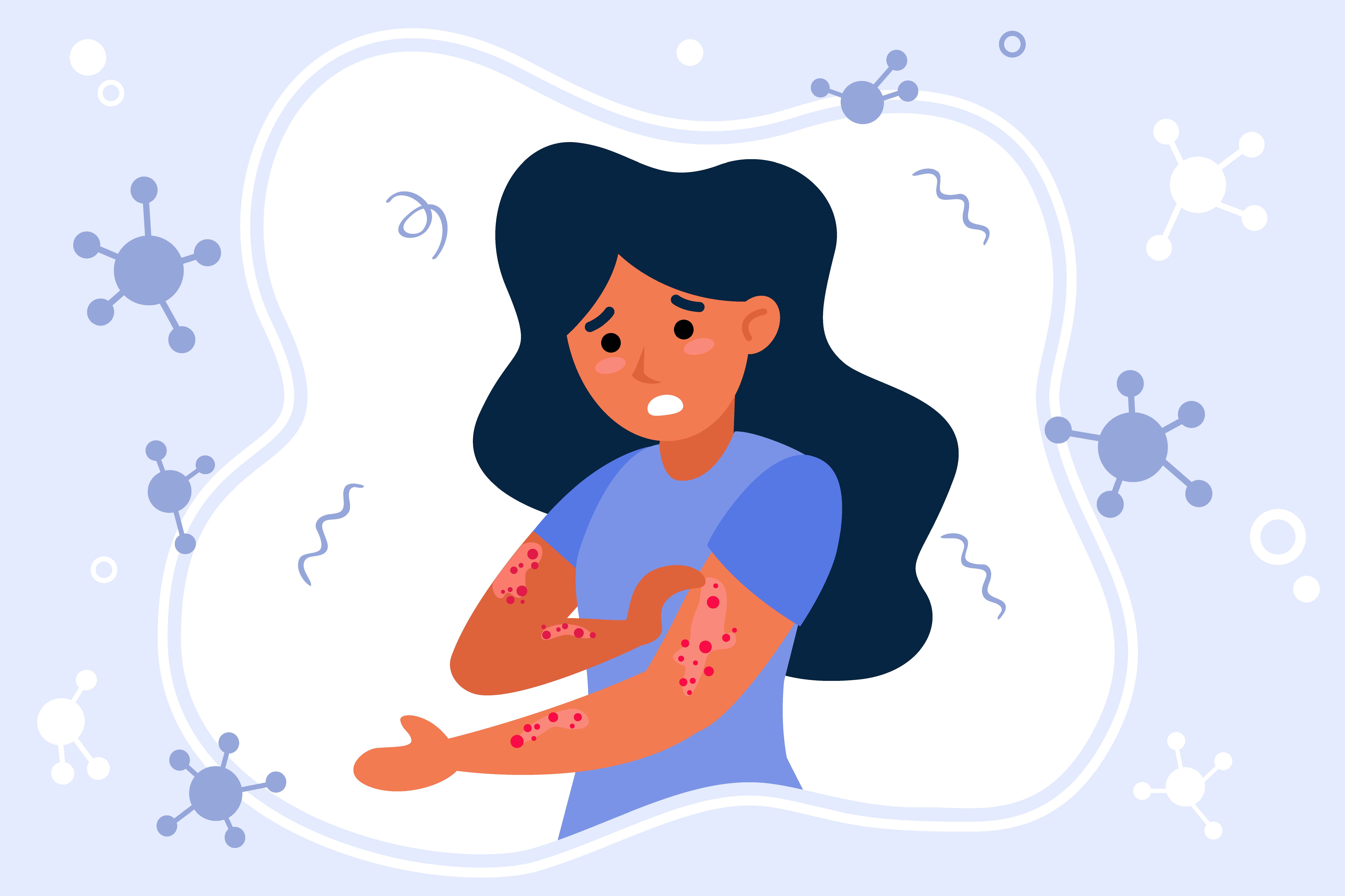 A cartoon image of a girl scratching at red dots generalized to her arms.